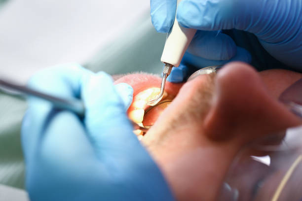 Best Emergency Denture Repair in Bunker Hill Village, TX