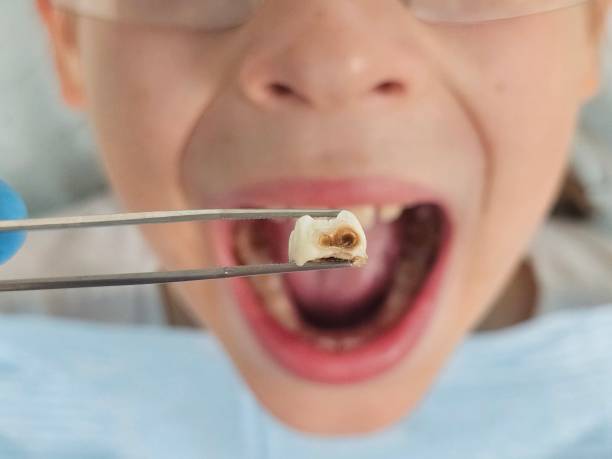 Best Emergency Pediatric Dental Care in Bunker Hill Village, TX